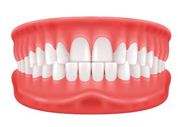 under bite